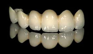 contour_specialists_connected_teeth